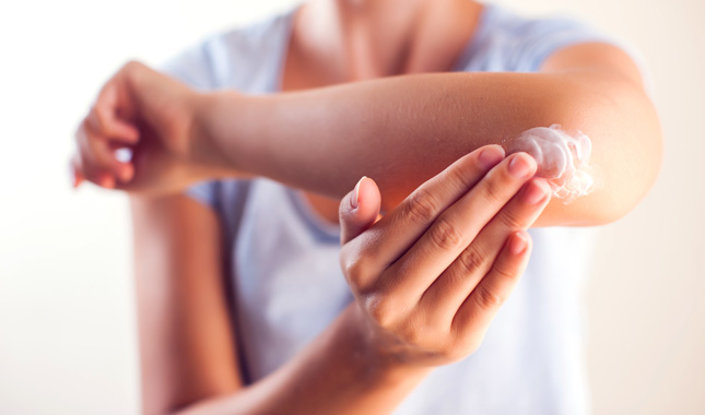 A young woman applies topical cream to her painful elbow